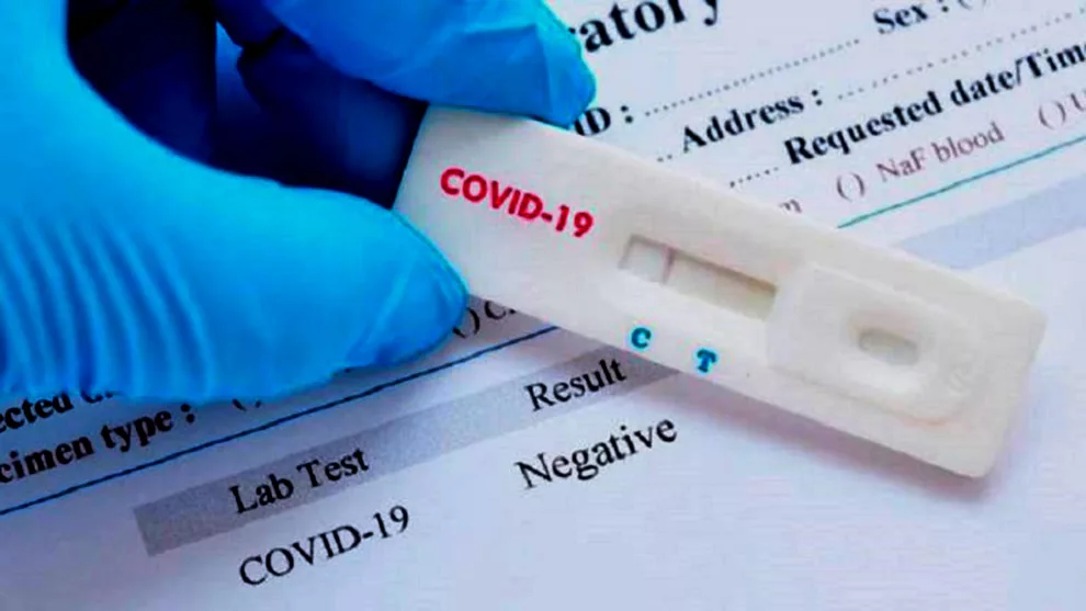 test covid para empleados